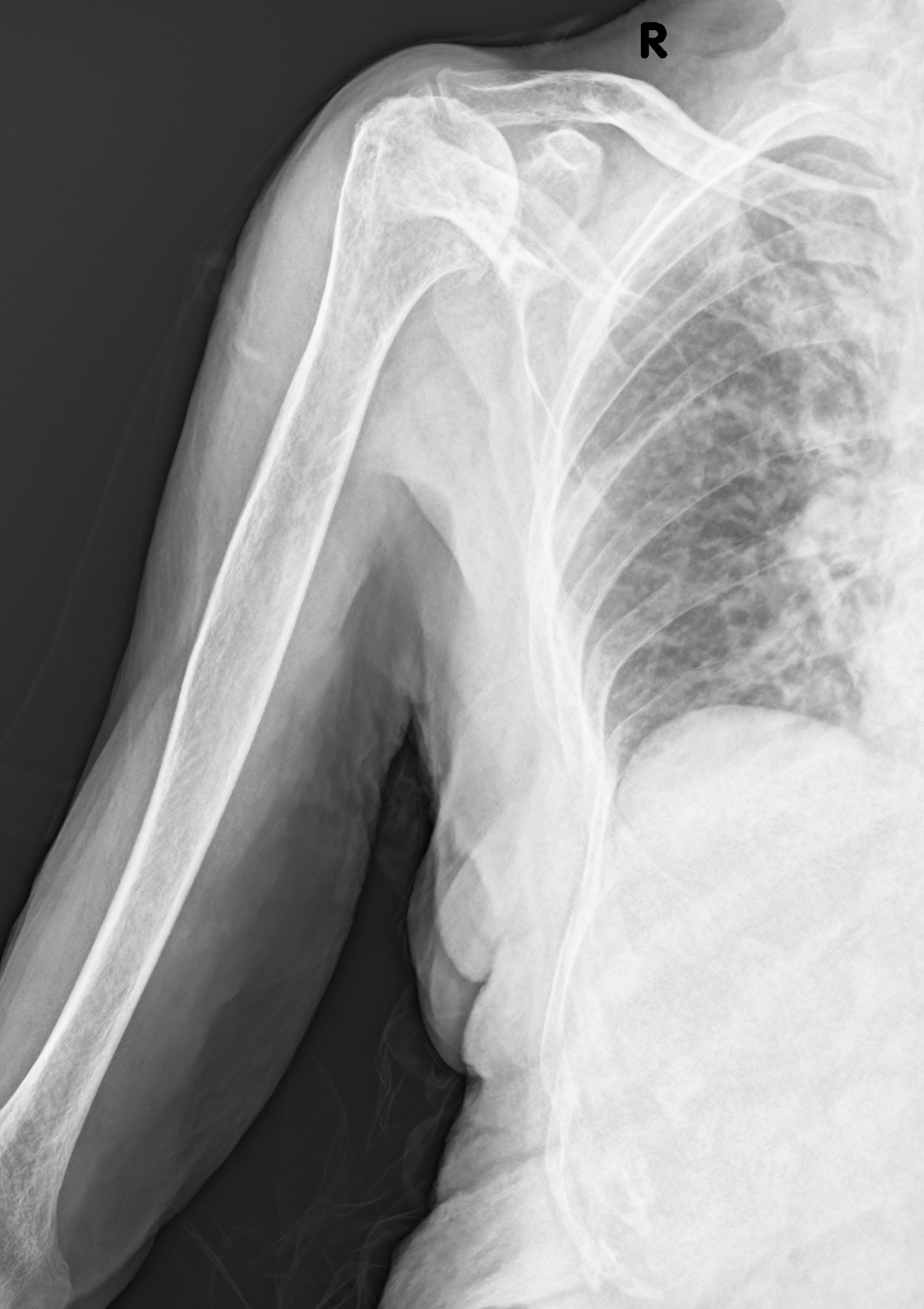 Radiografia della spalla eseguita a domicilio